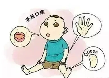 暑期手足口病来势汹汹，这份指南家长要掌握
