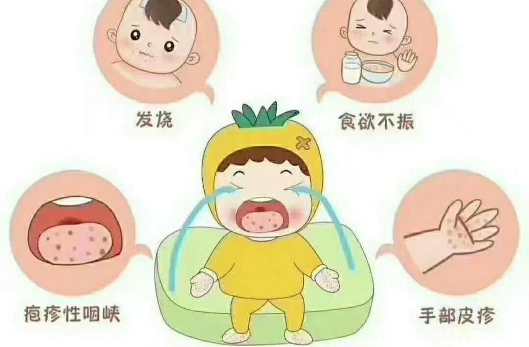 手足口病高发期！家长们该如何预防？
