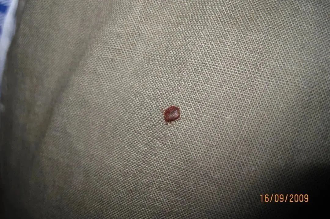 以人类血液为食！多国爆发，已蔓延至亚洲！
