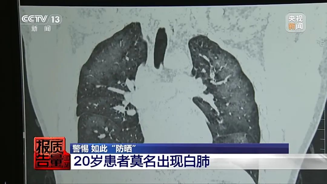 使用不慎引发白肺，还可能变喷火枪！这个“神器”要当心→